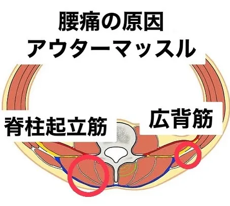 腰痛の原因、見つけてみませんか？