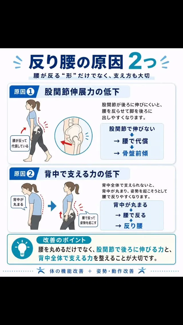 反り腰改善｜立ち方・歩き方のコツ