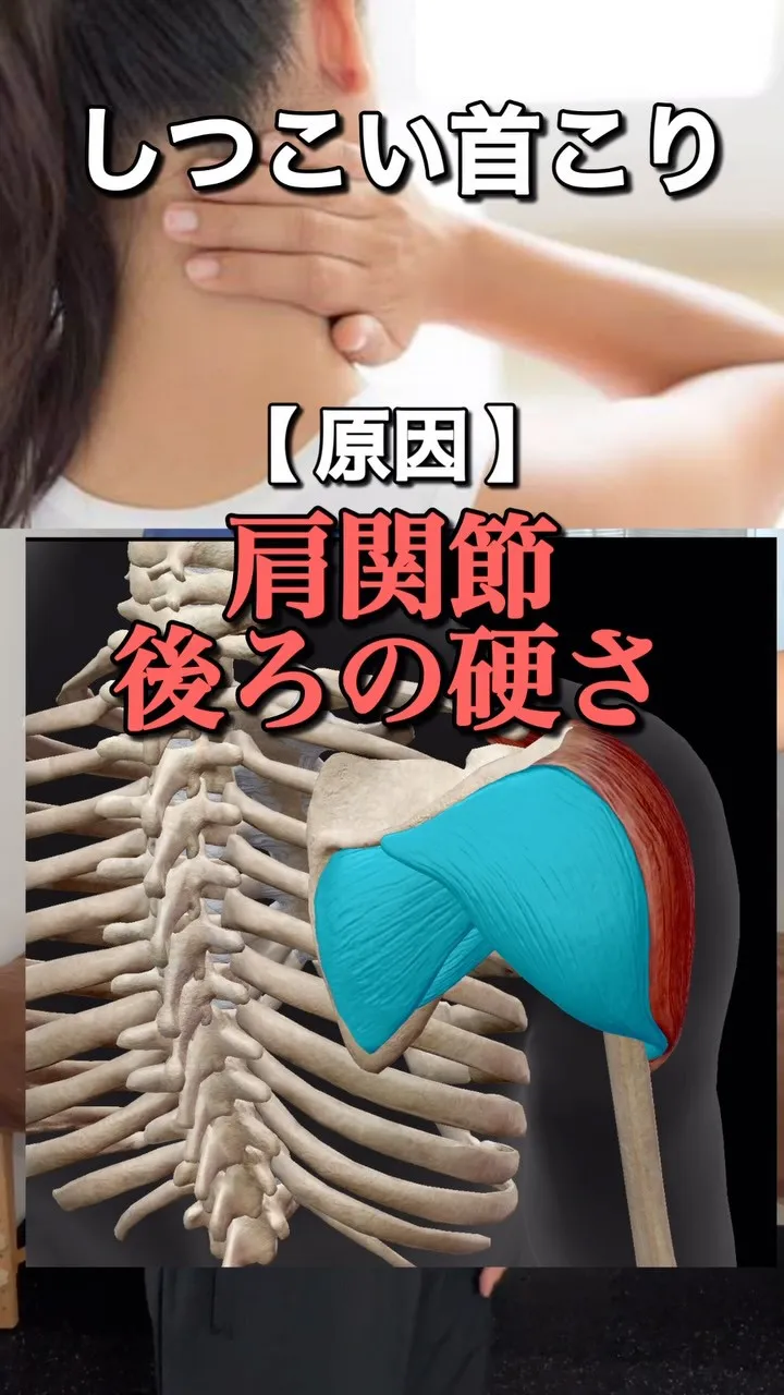 「首を揉んでも楽になるのはその場だけ…」